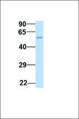 Anti-IGF2BP2 antibody produced in rabbit affinity isolated antibody