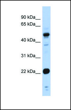 Anti-CSRP1 antibody produced in rabbit affinity isolated antibody