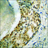 Anti-phospho-DDX3/DEAD-box Protein 3 (pThr322) antibody produced in rabbit affinity isolated antibody