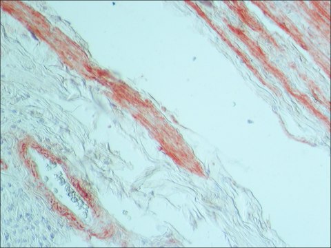 抗肌腱蛋白单克隆抗体 小鼠抗 clone BC-24, ascites fluid