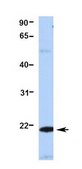 Anti-RGS5 antibody produced in rabbit affinity isolated antibody