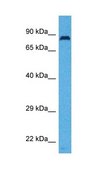 Anti-SLC26A4 antibody produced in rabbit affinity isolated antibody