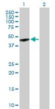 Anti-GPR143 antibody produced in mouse purified immunoglobulin, buffered aqueous solution