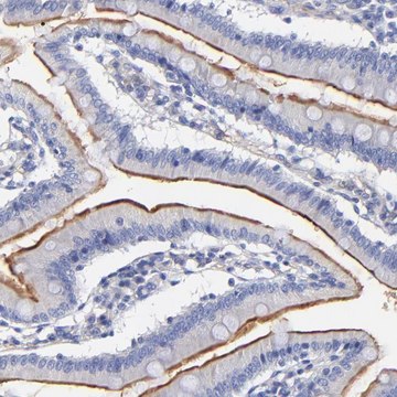 Anti-SLC44A2 antibody produced in rabbit Prestige Antibodies&#174; Powered by Atlas Antibodies, affinity isolated antibody, buffered aqueous glycerol solution