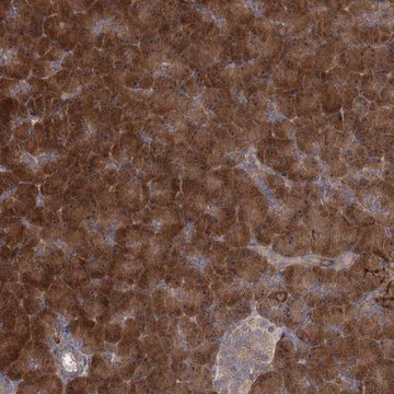 Anti-TBC1D9B antibody produced in rabbit Prestige Antibodies&#174; Powered by Atlas Antibodies, affinity isolated antibody, buffered aqueous glycerol solution