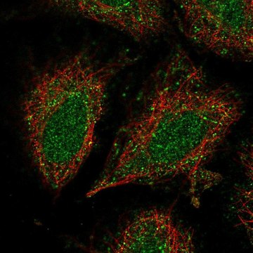 Anti-CCDC122 antibody produced in rabbit Prestige Antibodies&#174; Powered by Atlas Antibodies, affinity isolated antibody