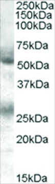 Anti-FLVCR antibody produced in goat affinity isolated antibody, buffered aqueous solution