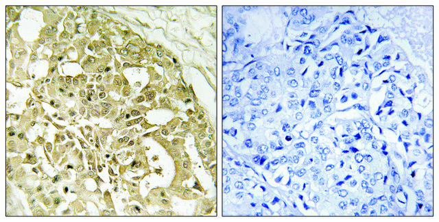 Anti-Catenin-&#946; antibody produced in rabbit affinity isolated antibody