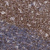 ANTI-KDM6A antibody produced in rabbit Prestige Antibodies® Powered by Atlas Antibodies, affinity isolated antibody, buffered aqueous glycerol solution