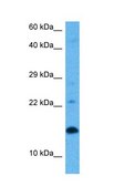 Anti-UBE2D1 antibody produced in rabbit IgG fraction of antiserum