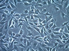 B16-OVA MO4 Mouse Melanoma Cell Line