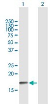 Anti-PPP3R2 antibody produced in mouse purified immunoglobulin, buffered aqueous solution