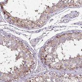 Anti-VGLL3 antibody produced in rabbit Prestige Antibodies® Powered by Atlas Antibodies, affinity isolated antibody, buffered aqueous glycerol solution
