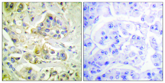 Anti-AHR antibody produced in rabbit affinity isolated antibody