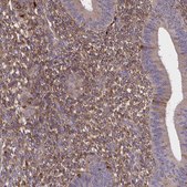 Anti-SFRP4 antibody produced in rabbit Prestige Antibodies® Powered by Atlas Antibodies, affinity isolated antibody, buffered aqueous glycerol solution