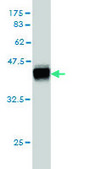 Monoclonal Anti-DSC3 antibody produced in mouse clone 4D2, purified immunoglobulin, buffered aqueous solution