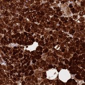 Anti-CPB1 antibody produced in rabbit Prestige Antibodies® Powered by Atlas Antibodies, affinity isolated antibody, buffered aqueous glycerol solution