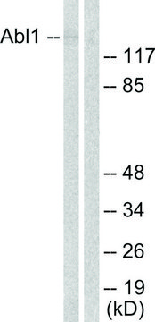 Anti-ABL antibody produced in rabbit affinity isolated antibody