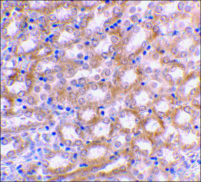 Anti-IRF3 antibody produced in rabbit affinity isolated antibody, buffered aqueous solution