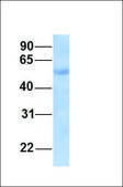 Anti-SEPT9 antibody produced in rabbit affinity isolated antibody