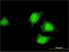 Monoclonal Anti-EDC4, (C-terminal) antibody produced in mouse clone 2E2, purified immunoglobulin, buffered aqueous solution