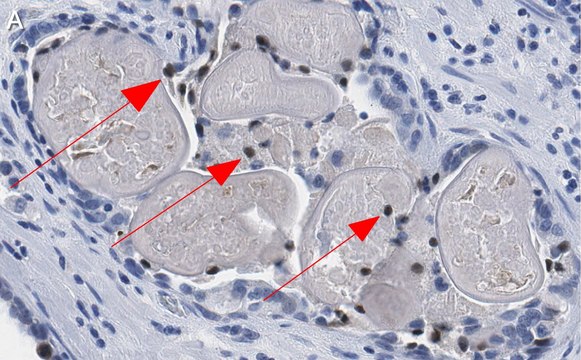 Anti-Phospho-HDAC7-(Ser486) Antibody, clone 3O11 ZooMAb&#174; Rabbit Monoclonal recombinant, expressed in HEK 293 cells