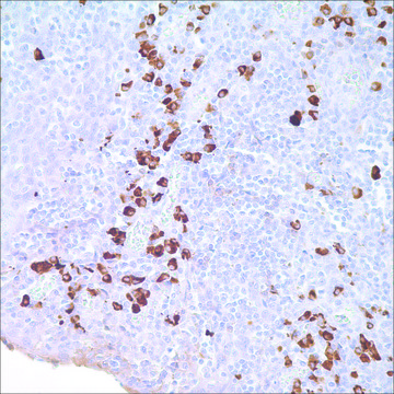 IgA Rabbit Polyclonal Antibody