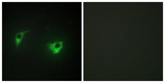 Anti-MEKKK 4 antibody produced in rabbit affinity isolated antibody