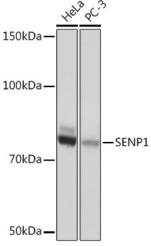 Anti-SENP1 Antibody, clone 1C3I4, Rabbit Monoclonal