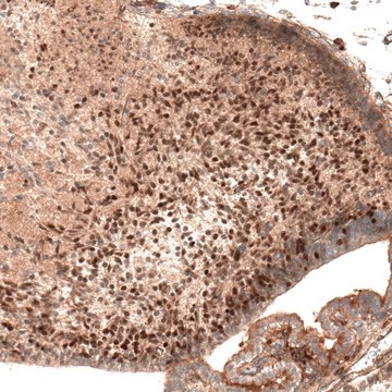 Monoclonal Anti-AUTS2 antibody produced in mouse Prestige Antibodies&#174; Powered by Atlas Antibodies, clone CL7067, purified immunoglobulin, buffered aqueous glycerol solution