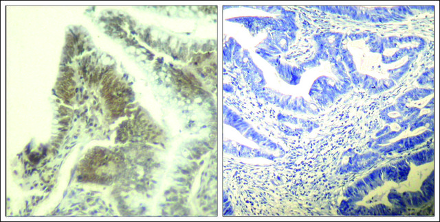 Anti-CDK6 (Ab-13) antibody produced in rabbit affinity isolated antibody