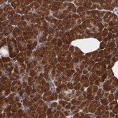Anti-STX5 antibody produced in rabbit Prestige Antibodies® Powered by Atlas Antibodies, affinity isolated antibody, buffered aqueous glycerol solution