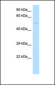 Anti-RIPK3 antibody produced in rabbit affinity isolated antibody
