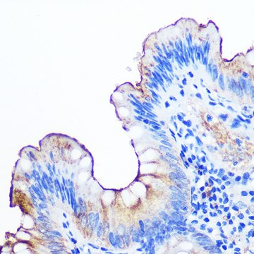 Anti-CEACAM1 Antibody, clone 0S9Z7, Rabbit Monoclonal