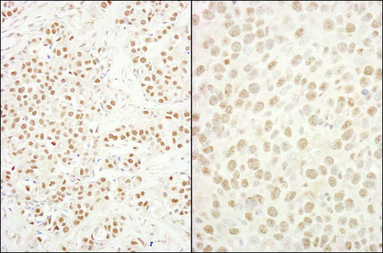 Rabbit anti-BRG1/SMARCA4 Antibody, Affinity Purified Powered by Bethyl Laboratories, Inc.