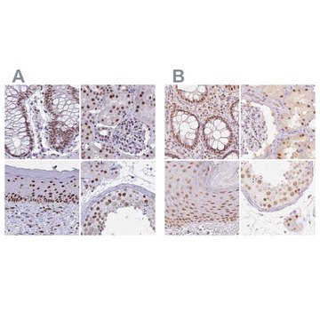 Anti-PPP1R10 antibody produced in rabbit Prestige Antibodies&#174; Powered by Atlas Antibodies, affinity isolated antibody, buffered aqueous glycerol solution