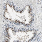 Anti-TM9SF2 antibody produced in rabbit Prestige Antibodies® Powered by Atlas Antibodies, affinity isolated antibody, buffered aqueous glycerol solution