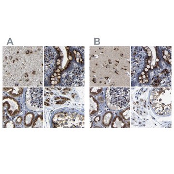 Anti-TGOLN2 antibody produced in rabbit Prestige Antibodies&#174; Powered by Atlas Antibodies, affinity isolated antibody, buffered aqueous glycerol solution