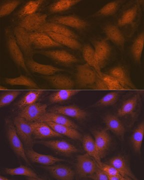 Anti-RAIDD/CRADD Antibody, clone 3Z9N8, Rabbit Monoclonal