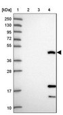 Anti-CEACAM16 antibody produced in rabbit Prestige Antibodies® Powered by Atlas Antibodies, affinity isolated antibody, buffered aqueous glycerol solution