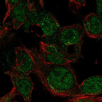 Anti-LYZ antibody produced in rabbit Prestige Antibodies&#174; Powered by Atlas Antibodies, affinity isolated antibody