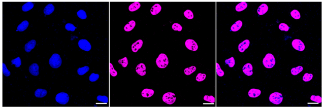 Anti CYP24A1 Antibody, clone 23GB3795, Rabbit Monoclonal clone 23GB3795, recombinant rabbit monoclonal, expressed in HEK293 cells