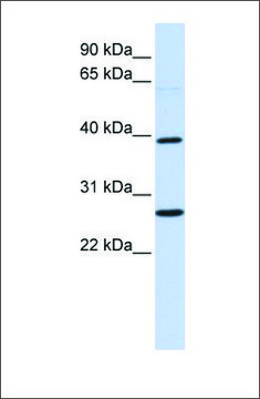 Anti-WNT16 antibody produced in rabbit affinity isolated antibody