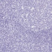 Anti-CPA1 antibody produced in rabbit Prestige Antibodies® Powered by Atlas Antibodies, affinity isolated antibody, buffered aqueous glycerol solution