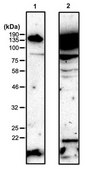Anti-Phosphohistidine (pHis) from rabbit, purified by affinity chromatography
