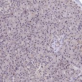 Anti-RIOK1 antibody produced in rabbit Prestige Antibodies® Powered by Atlas Antibodies, affinity isolated antibody, buffered aqueous glycerol solution