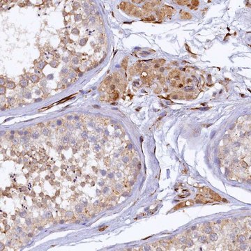 Anti-ARL11 antibody produced in rabbit Prestige Antibodies&#174; Powered by Atlas Antibodies, affinity isolated antibody, buffered aqueous glycerol solution