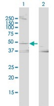 Anti-LCAT antibody produced in rabbit purified immunoglobulin, buffered aqueous solution