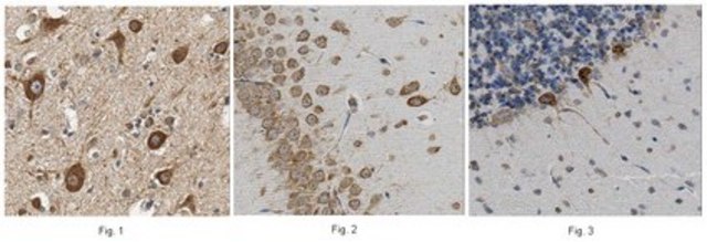 Anti-NDUFS3 Antibody, clone 6H7.1 clone 6H7.1, from mouse