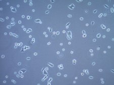 VCaP-EnzR Human Enzalutamide Resistant Prostate Cell Line